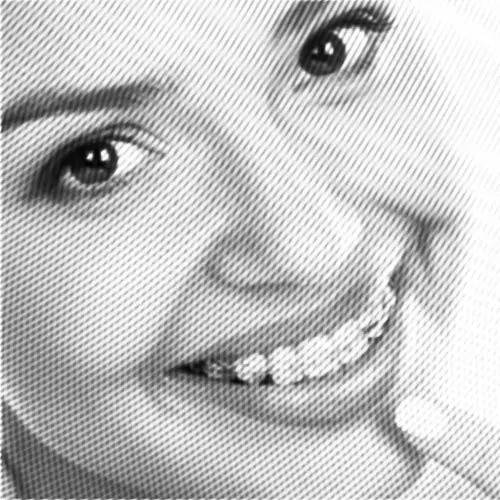 junge frau zeigt ihre feste Spange mit keramikbrackets